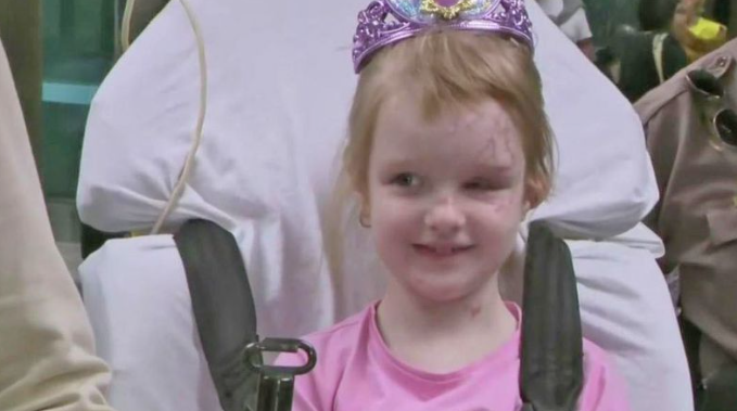 Girl, 6, being treated in South Florida following Ukrainian blast injuries